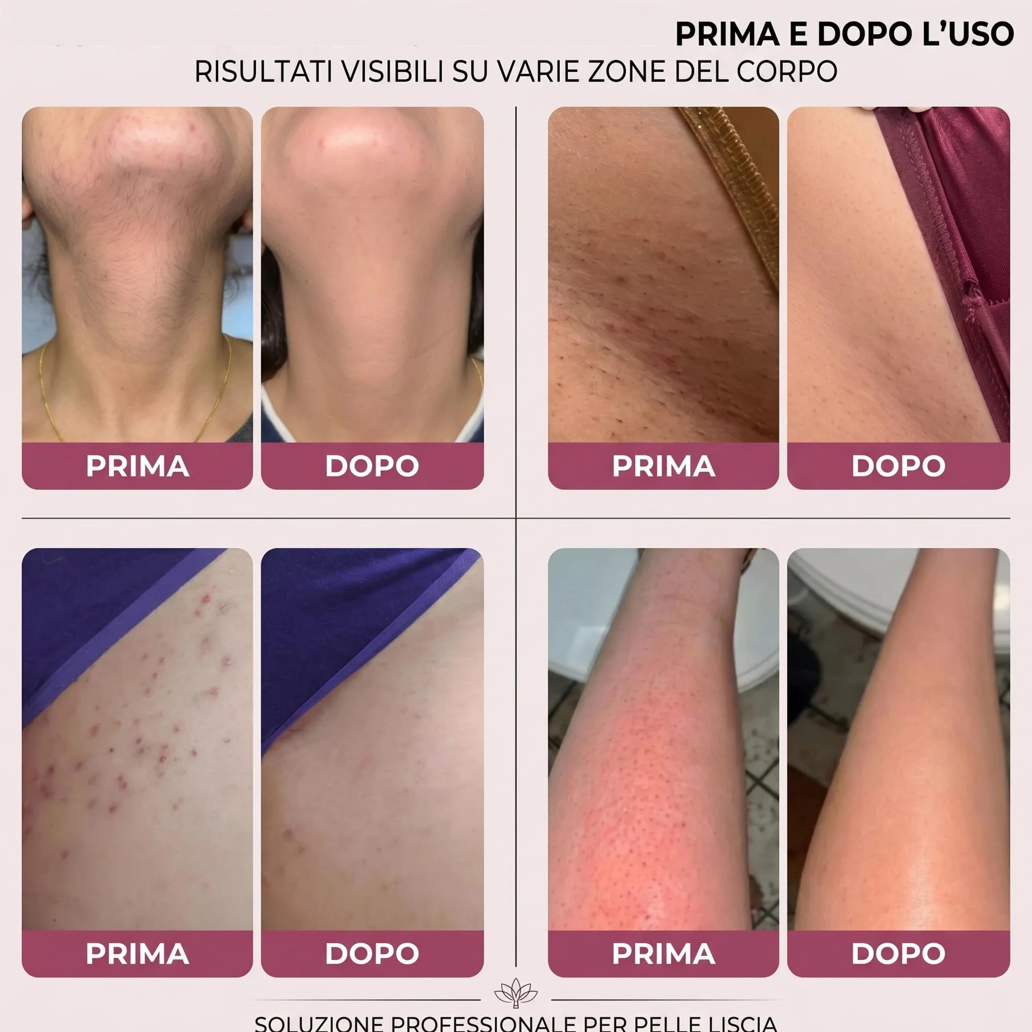 Glorya Rasoio Elettrico Donna 2 in 1 IPX7 Lame in Ceramica Ricaricabile Trimmer Bikini