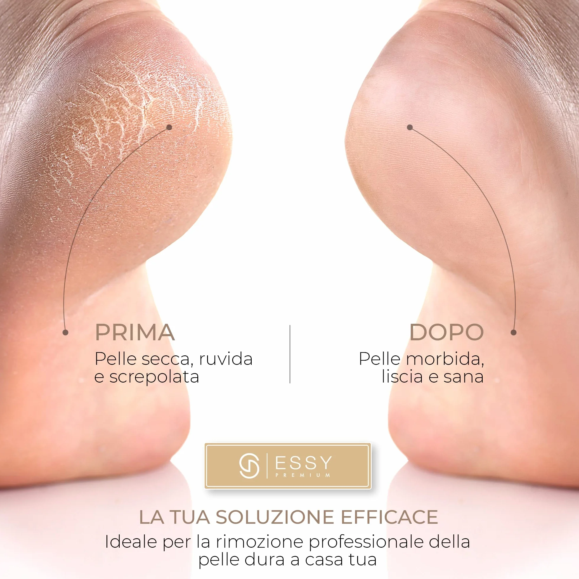 Essy Levigatore Elettrico per Piedi con 5 Rulli di Ricambio, Lima Ricaricabile per Rimozione Calli, 2 Velocità, Display LED, Ricarica USB, Kit Pedicure Bianco