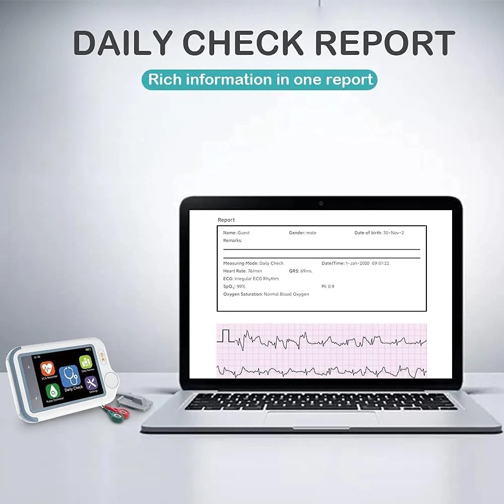 Wellue Checkme Lite Plus - Monitor ECG e ossimetro | Misura ECG/SpO2 in 20 secondi | Bluetooth| Sensore portatile + app (iOS/Android)