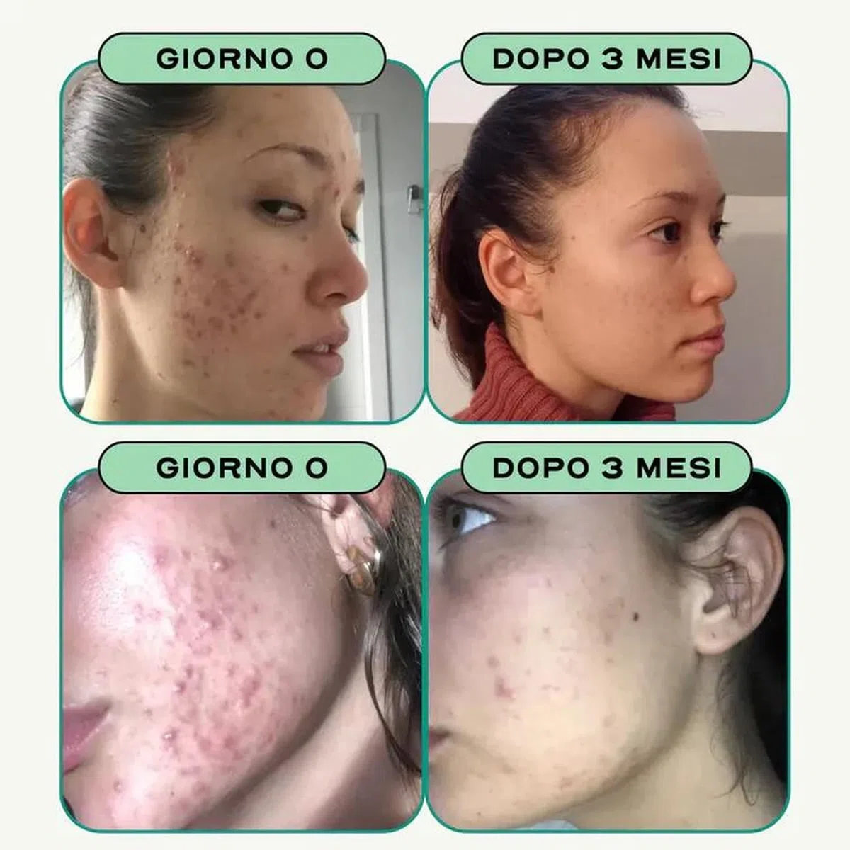 Circles CLEAR + BALANCE Duo Donna - Acne Ormonale & Equilibrio Ormonale - Zinco + Magnesio Bisglicinato + Agnocasto Bardana Rodiola - Post-Pillola SPM Ciclo Femminile - 120 Capsule Vegan Francia